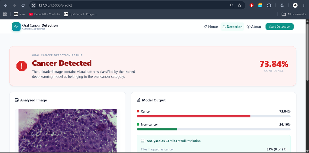 Oral Cancer Detection Using Deep Learning