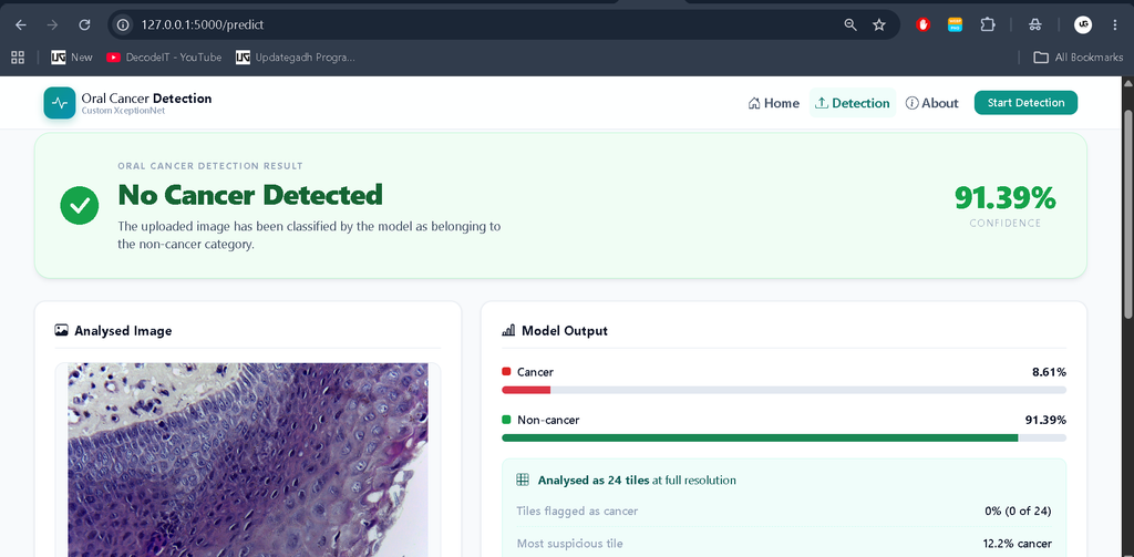 Oral Cancer Detection Using Deep Learning