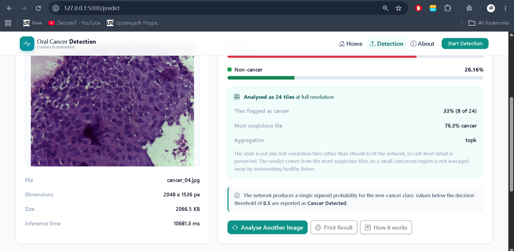 Oral Cancer Detection Using Deep Learning